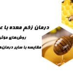 درمان زخم معده با عسل طبیعی: روشهای مؤثر و مقایسه با سایر درمانهای گیاهی