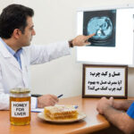 عسل و کبد چرب: آیا مصرف عسل به بهبود کبد چرب کمک میکند؟